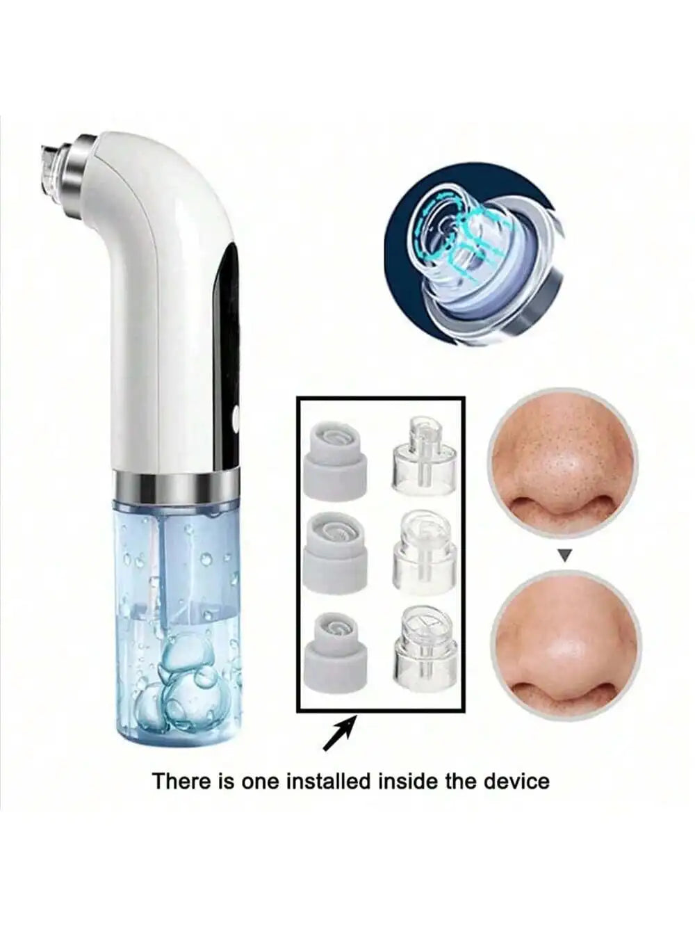 Facial Pore Cleansing Vacuum