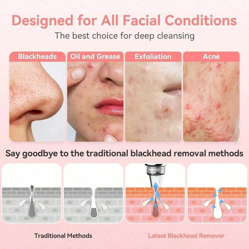 Blackhead Remover Pore Vacuum