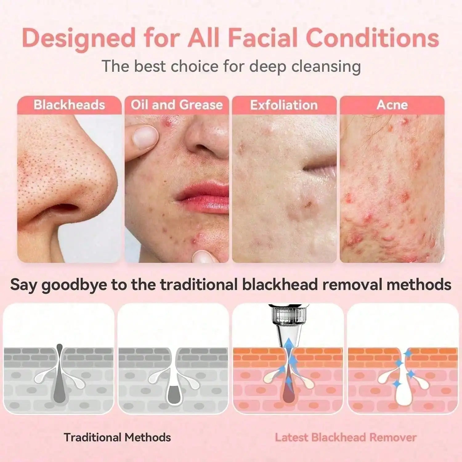 Blackhead Remover Pore Vacuum