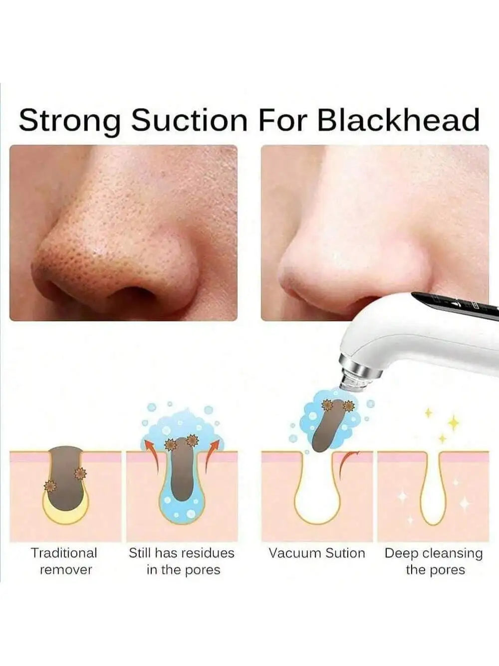 Facial Pore Cleansing Vacuum